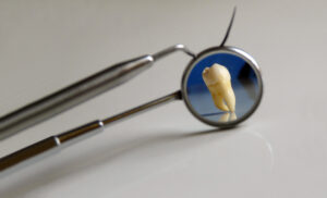 A fogimplantáció akár 72 óra alatt elkészül